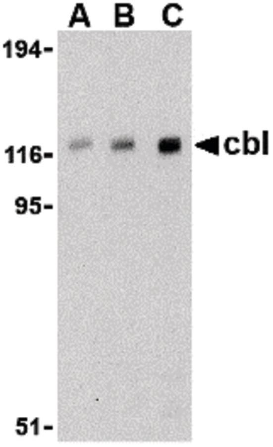 Polyclonal Rabbit anti-Human c-CBL Antibody (IF, WB)
