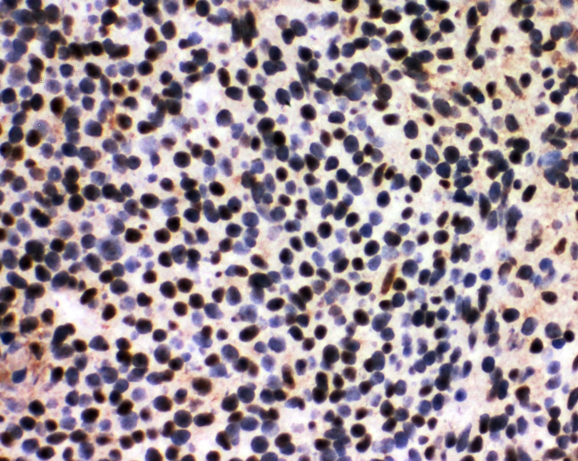 SF1 Antibody (aa11-30)