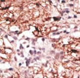 KDM1A / LSD1 Antibody (aa108-142)