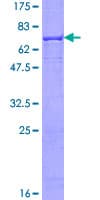 Human ALKBH1 / ALKB Protein (Recombinant GST)