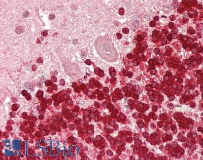 IHC-plus™ TALDO1 / Transaldolase 1 Antibody (aa267-317)