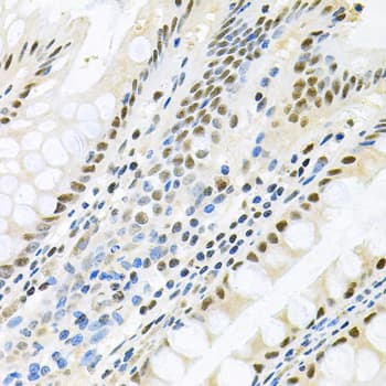 Polyclonal Rabbit anti-Human MAPK8 / JNK1 Antibody (IHC, IF, WB)