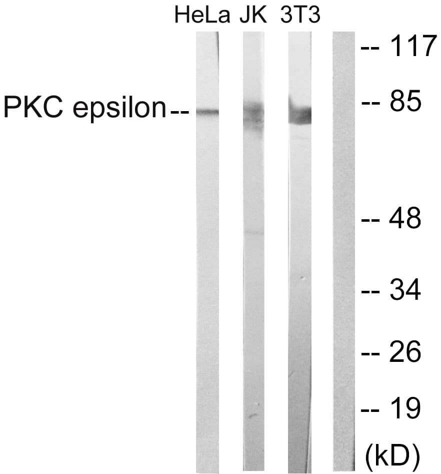 IHC-plus™ PRKCE / PKC-Epsilon Antibody (aa688-737)