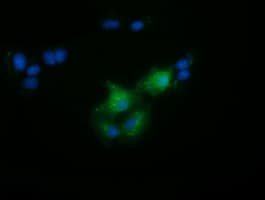 FAM84B Antibody (clone OTI5G1)