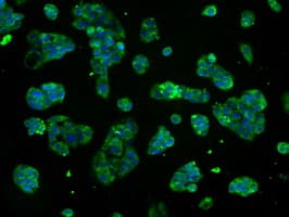 ATP5B / ATP Synthase Beta Antibody (clone OTI6C4)