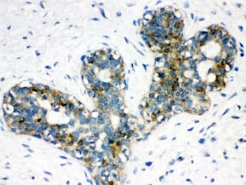 ARSA / Arylsulfatase A Antibody