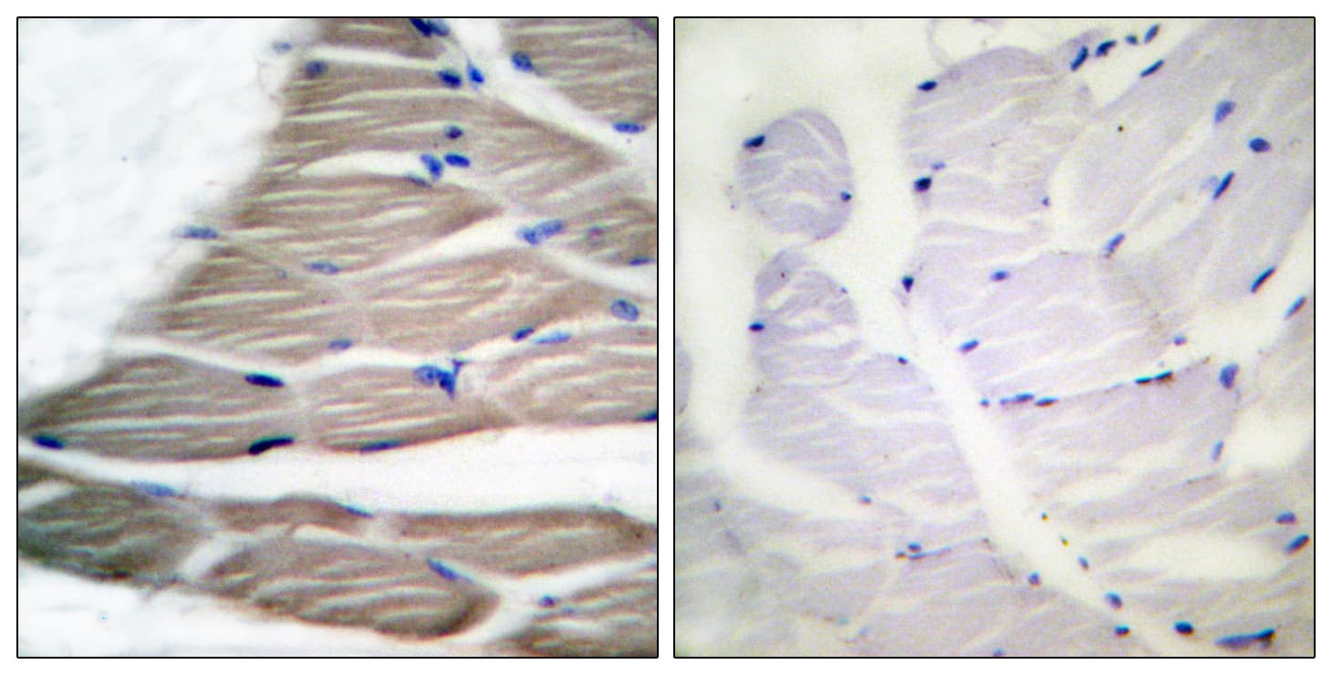 Acetyl-CoA Carboxylase / ACC Antibody (phospho-Ser80)