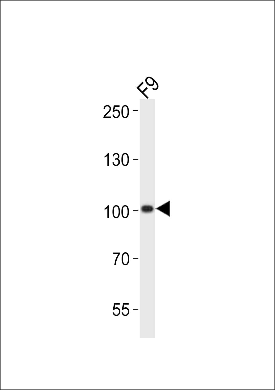 SUZ12 Antibody (aa496-530)