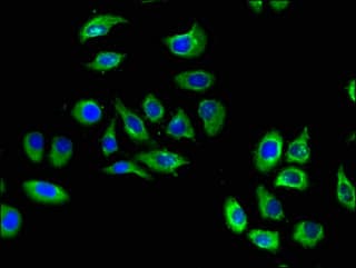 S1PR5 / EDG8 / S1P5 Antibody