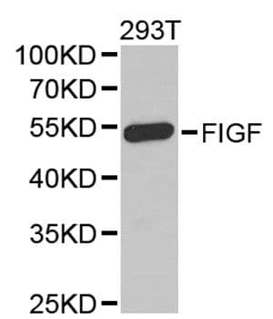 Polyclonal Rabbit anti-Human VEGFD Antibody (WB)