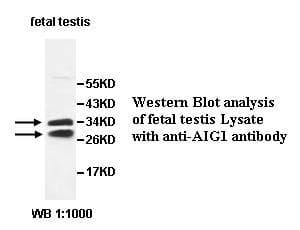 AIG1 Antibody