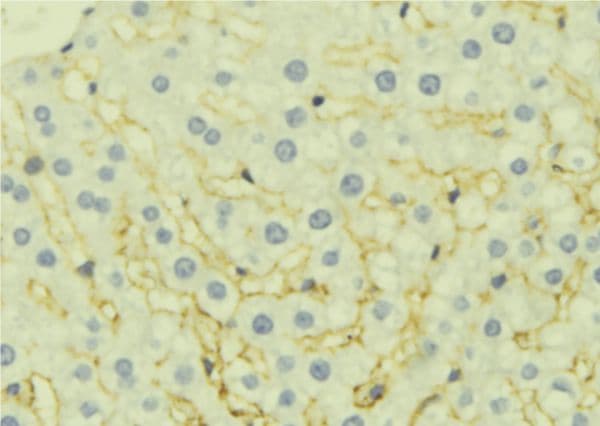 EPHX1 / Epoxide Hydrolase 1 Antibody