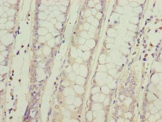 SPCS2 Antibody