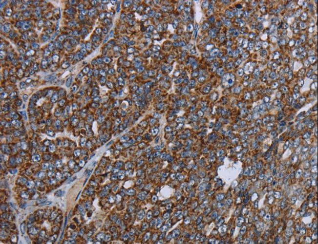 NDUFA13 / GRIM19 Antibody