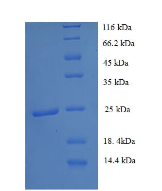 Human HDAC9 Protein (Recombinant His)
