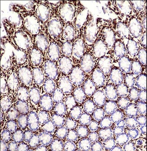 Vimentin Antibody