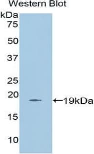 FDFT1 / Squalene Synthase Antibody (aa269-417, APC)