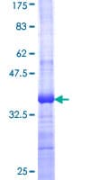 Human WNT7B Protein (Recombinant GST, N-terminus)