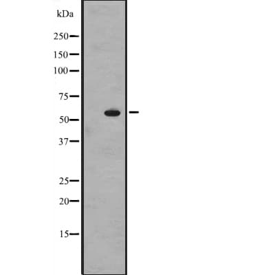 Polyclonal Rabbit anti-Human ZNF71 Antibody (IHC, WB)