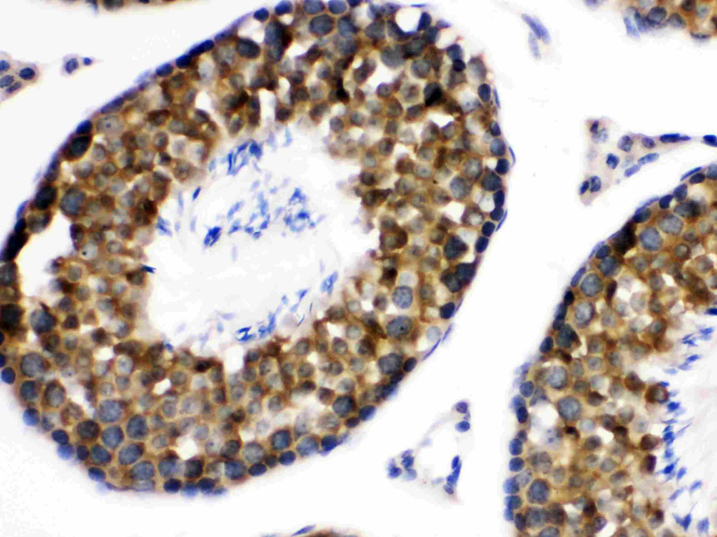 Polyclonal Rabbit anti-Human WNK1 Antibody (IHC, WB)