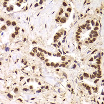 PHAP1 / ANP32A Antibody