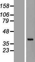 GET4 Protein (Over-Expression Lysate Myc-DDK (Flag))