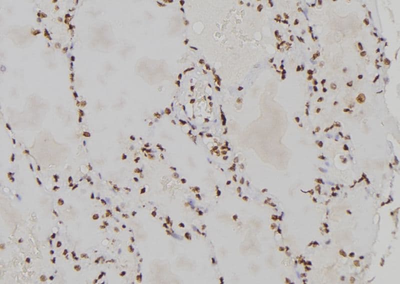 Polyclonal Rabbit anti-Human CENPL Antibody (IHC, WB)