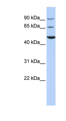 KCND3 / Kv4.3 Antibody (aa432-481)