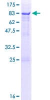 Human SDR / SDPR Protein (Recombinant GST)