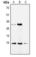 PathPlus™ CDA / Cytidine Deaminase Antibody