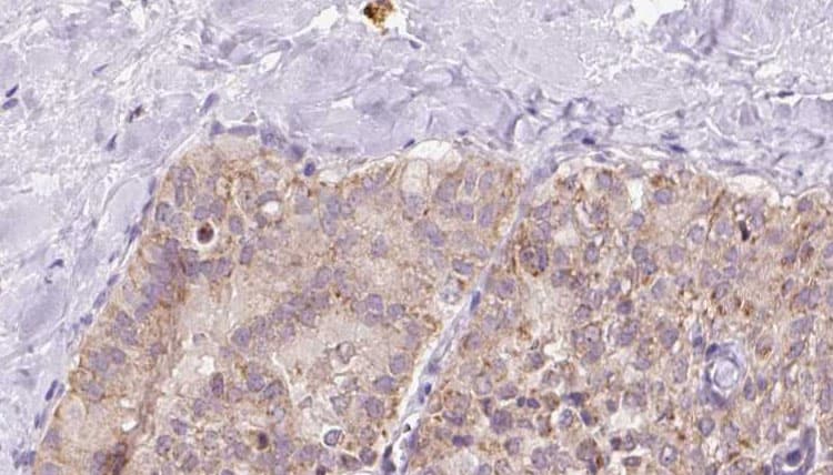 UQCRQ Antibody