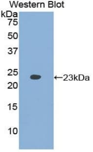 LAMA5 / Laminin Alpha 5 Antibody (aa3517-3718)