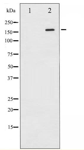 Polyclonal Rabbit anti-Human EGFR Antibody (phospho-Tyr1110, WB)