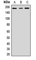 Polyclonal Rabbit anti-Human NCOA2 / TIF2 Antibody (WB)