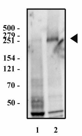 Monoclonal Mouse anti-Human FN1 / Fibronectin Antibody (clone 2F4, IHC, WB)