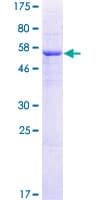 Human TRMT61A / TRM61 Protein (Recombinant GST)