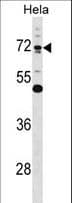 Epsin 1 / EPN1 Antibody (aa203-232)