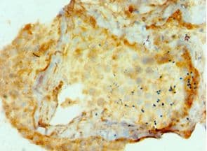 Polyclonal Rabbit anti-Human AMHR2 / MISRII Antibody (aa18-149, IHC, WB)