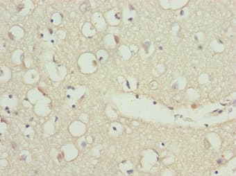 ZNF264 Antibody