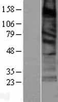 SURF4 Protein (Over-Expression Lysate Myc-DDK (Flag))