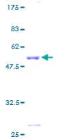 Human GSTA4 Protein (Recombinant GST)