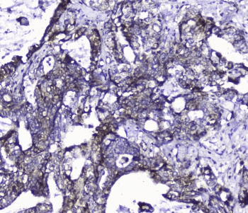 Polyclonal Rabbit anti-Human CDK6 Antibody (IHC, WB)