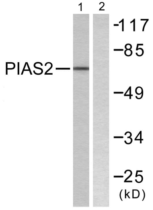 PIAS2 / PIASX Antibody