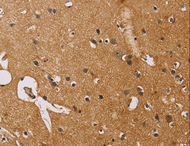 Polyclonal Rabbit anti-Human NRN1 / Neuritin Antibody (IHC)