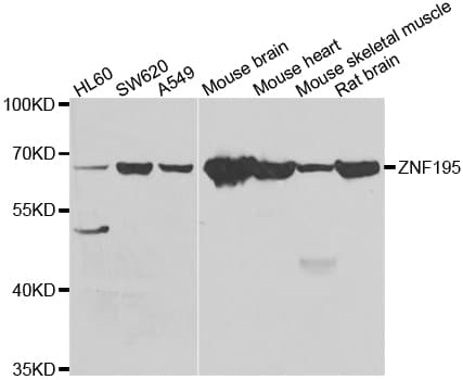 ZNF195 Antibody