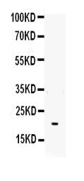 IL6 / Interleukin 6 Antibody (aa29-212)