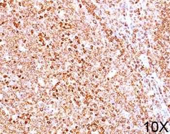 CD79A / CD79 Alpha Antibody (aa202-216, clone HM47/A9, Azide-free, BSA-free)