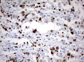 MKI67 / Ki67 Antibody (aa1160-1493, clone OTI13B11)
