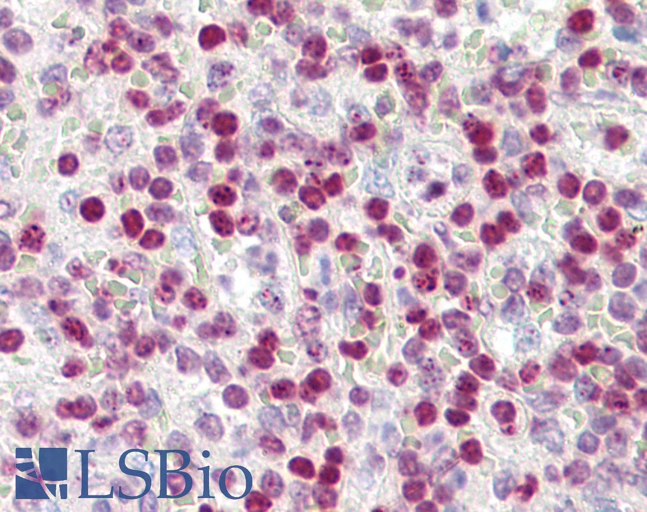 IHC-plus™ Polyclonal Rabbit anti-Human Histone H2A.X Antibody (aa100-143, IHC, WB)