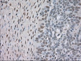 Monoclonal Mouse anti-Human NTRK3 / TRKC Antibody (clone OTI4E10, IHC, IF, WB)